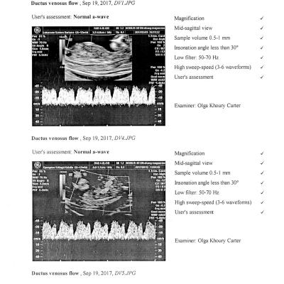 Zsuzsa Fmf Audit Details 2017