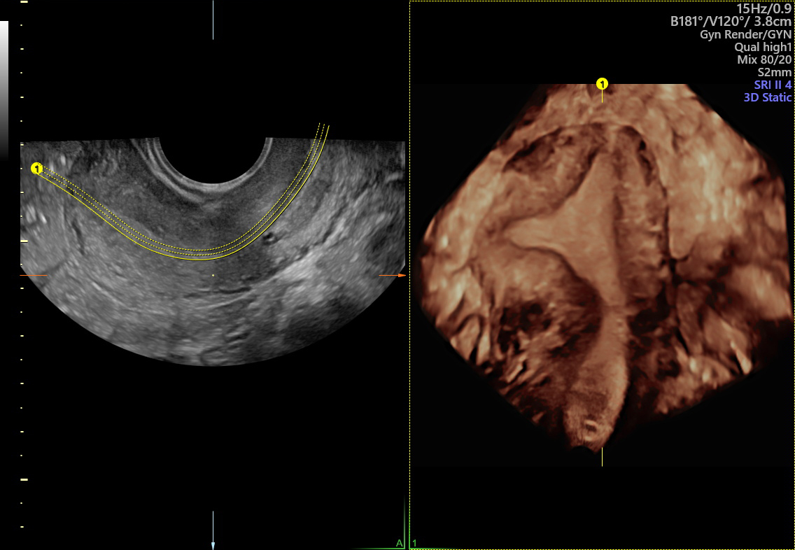 4d hasi ultrahang Natal Calca Prostate Vélemények