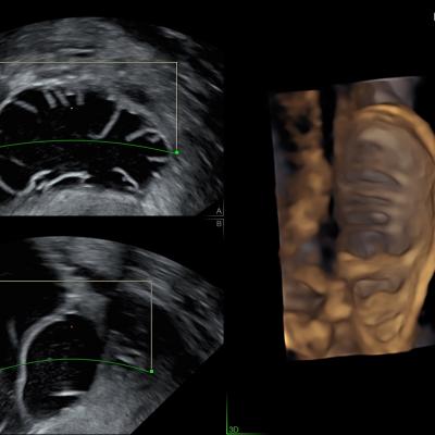 Ultrahang vizsgálatok | Aniron Magánklinika | Pécs