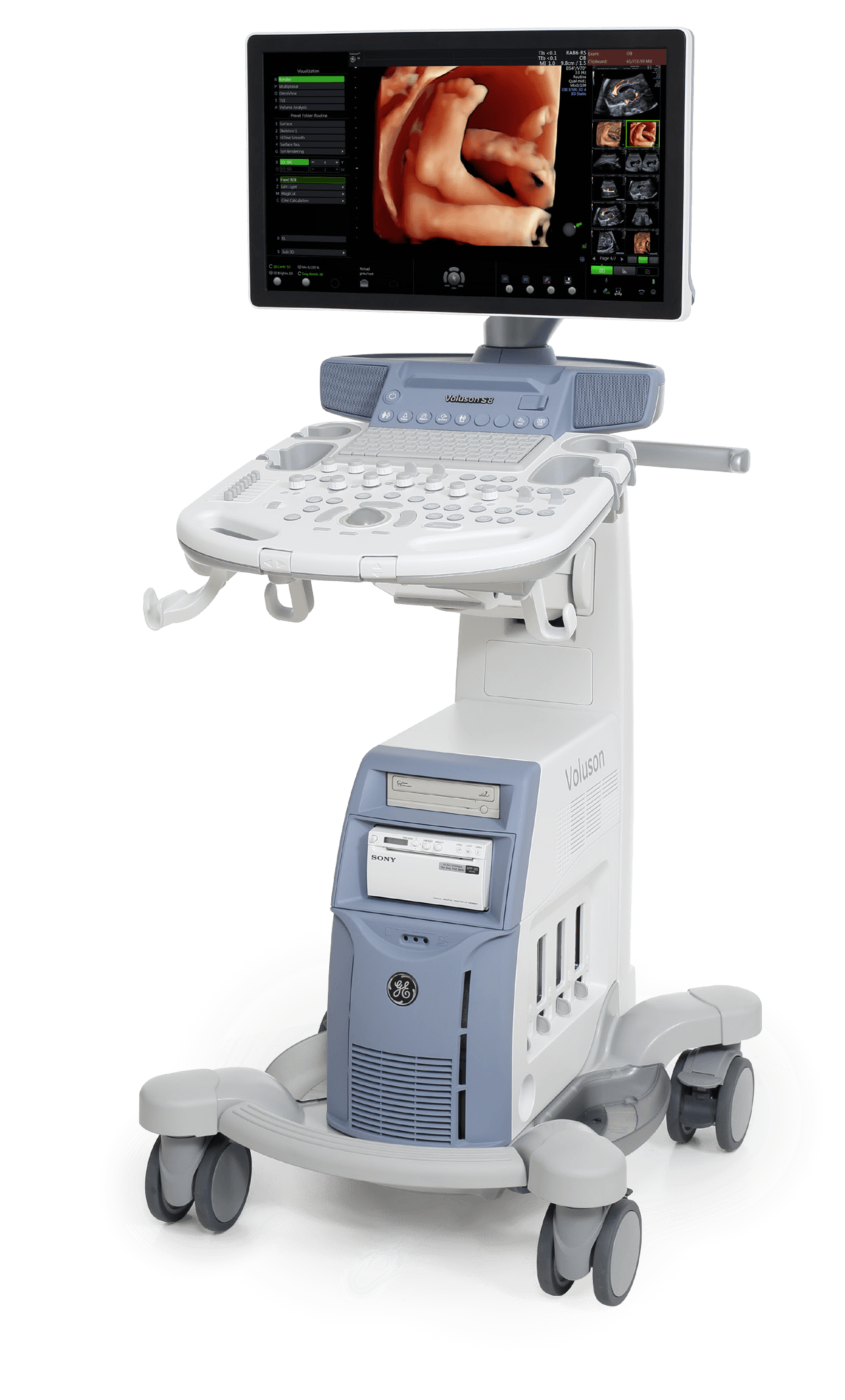 GE Healthcare Voluson S8 BT18 típusú ultrahang készülék